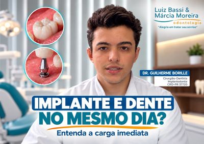 T&eacute;cnica de carga imediata pode reduzir etapas do tratamento, mas depende das condi&ccedil;&otilde;es de cada paciente.