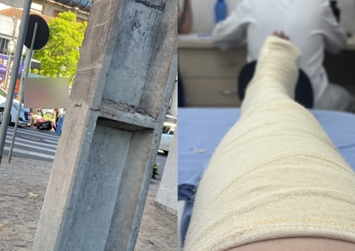 Bruna Padilha Melnyk est&aacute; em recupera&ccedil;&atilde;o e afirma que dever&aacute; ficar cerca de tr&ecirc;s meses sem trabalhar