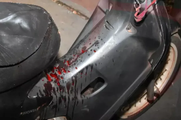 Baleado no pesco&ccedil;o, motociclista pede ajuda em hospital e &eacute; intubado em MS