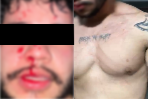 Suspeito de agress&atilde;o contra ex-namorada apresenta sua vers&atilde;o e nega acusa&ccedil;&otilde;es