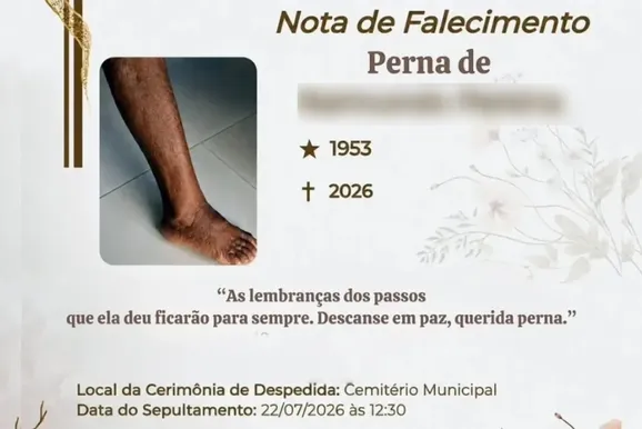 Perna amputada pode ser enterrada? Entenda o procedimento ap&oacute;s caso na regi&atilde;o