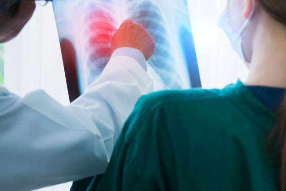 Paranava&iacute; registra queda nos casos de tuberculose em 2026