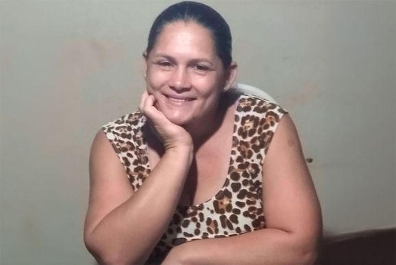 Mulher morre ap&oacute;s sofrer queimaduras durante comemora&ccedil;&atilde;o do pr&oacute;prio anivers&aacute;rio