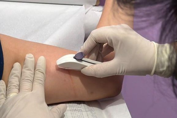 Sumar&eacute; prepara enfermeiros para ampliar acesso ao Implanon nas unidades de sa&uacute;de