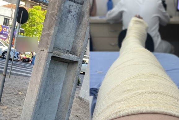 Manicure pede ajuda ap&oacute;s sofrer atropelamento e fraturar o joelho