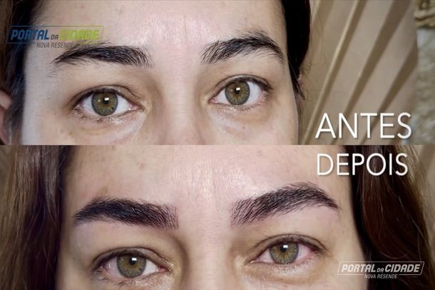 Procedimento delicado e personalizado destaca a for&ccedil;a e a beleza de cada mulher.