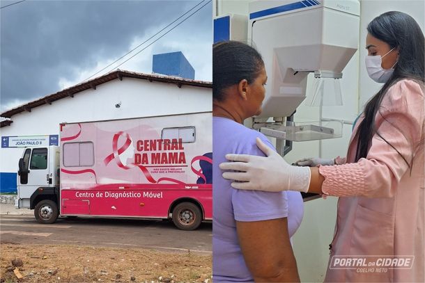 Realiza&ccedil;&atilde;o de exames de mamografia 