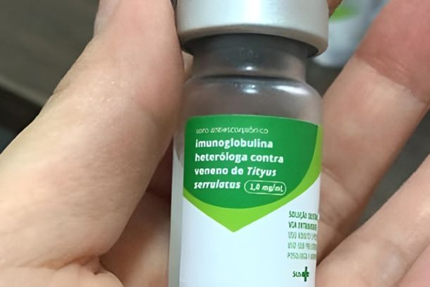 Andradas dispõe de soro antiescorpiônico