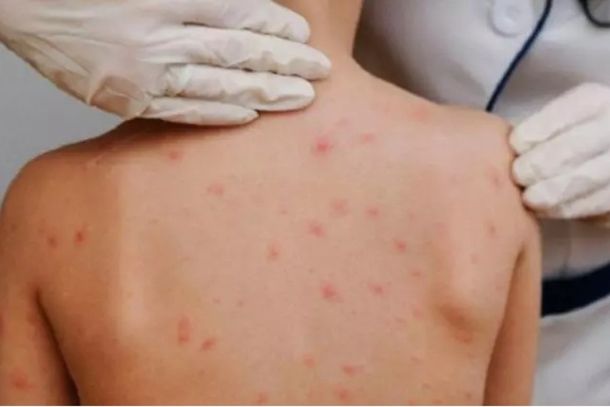 Profissionais de sa&uacute;de atuam nas institui&ccedil;&otilde;es para inspe&ccedil;&atilde;o das crian&ccedil;as