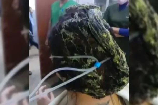 Cola grudada no cabelo da mulher. (Reprodu&ccedil;&atilde;o, La Nacion)