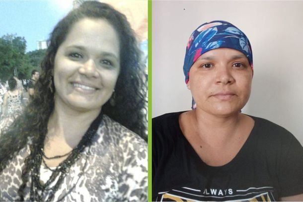 Antes e depois de Kassia Liarte, 38 anos