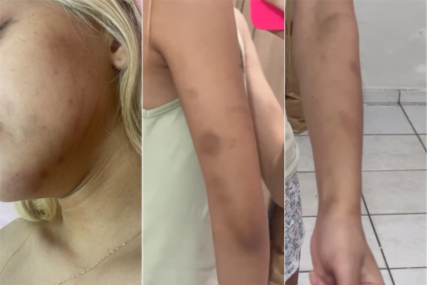 Jovem v&iacute;tima de viol&ecirc;ncia dom&eacute;stica em Coelho Neto   