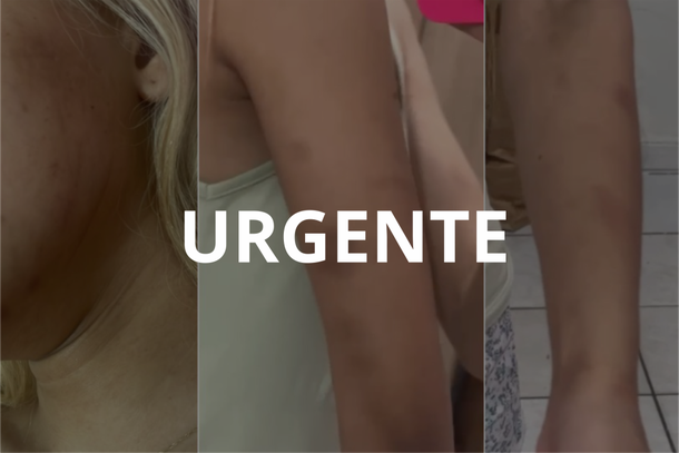 Jovem v&iacute;tima de viol&ecirc;ncia dom&eacute;stica em Coelho Neto   