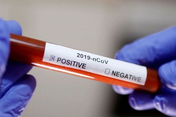 Sete casos suspeitos foram descartados e sete adicionados pelas autoridades de sa&uacute;de nesta quarta