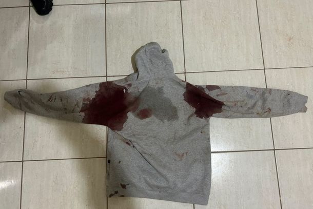 Confus&atilde;o em bar no distrito de Paulist&acirc;nia terminou com um jovem esfaqueado e um homem atropelado durante a fuga do suspeito.