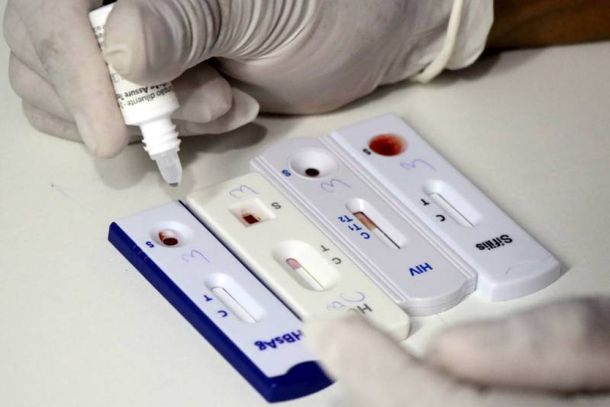 Testes r&aacute;pidos gratuitos e sigilosos est&atilde;o dispon&iacute;veis nas UBSs de Ibaiti para HIV, s&iacute;filis e hepatites.