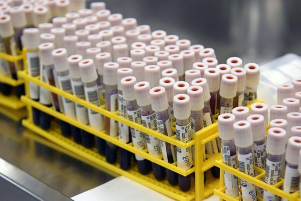 Em mar&ccedil;o de 2020, a revista cient&iacute;fica Lancet Infectious Diseases publicou o relato de dois casos cl&iacute;nicos em Singapura que apresentaram testes positivos para a dengue e para a covid-19.