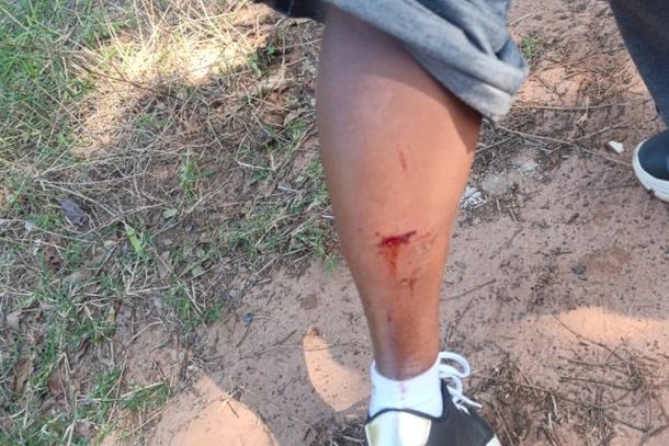No local, os agentes constataram que a v&iacute;tima sofreu uma mordida na panturrilha da perna direita, resultando em uma les&atilde;o que necessitou de atendimento m&eacute;dico.