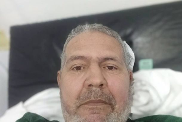 De acordo com Paulo, os problemas come&ccedil;aram ap&oacute;s um grave acidente de motocicleta. Na &eacute;poca, ele passou por uma cirurgia na perna direita.