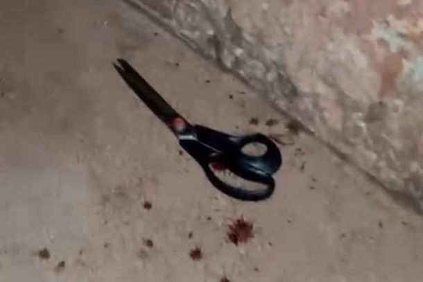 A suspeita teria cometido a agress&atilde;o por n&atilde;o aceitar o t&eacute;rmino do relacionamento.