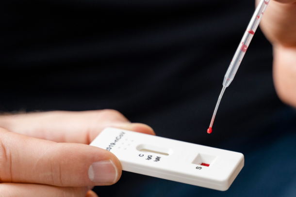 Exames podem ser realizados de forma sigilosa no SINAS, sem necessidade de apresentar sintomas.