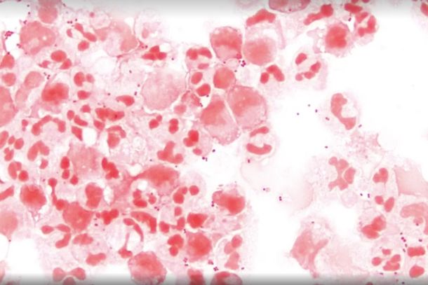 Neisseria meningitidis, a bact&eacute;ria que causa a meningite meningoc&oacute;cica. &mdash; Foto: Wikimedia