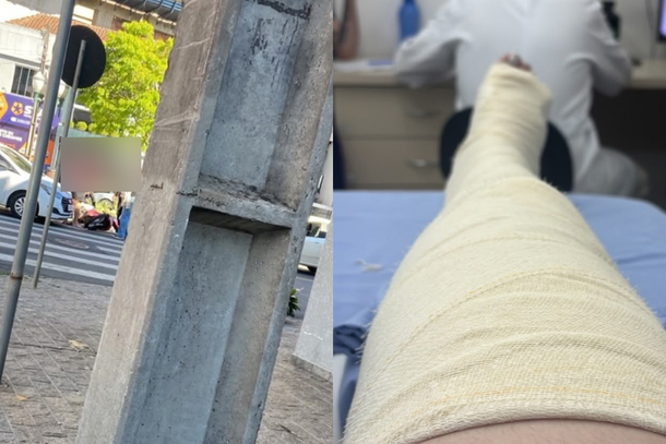 Manicure pede ajuda ap&oacute;s sofrer atropelamento e fraturar o joelho