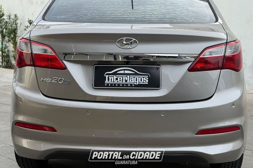 Hyundai HB20S