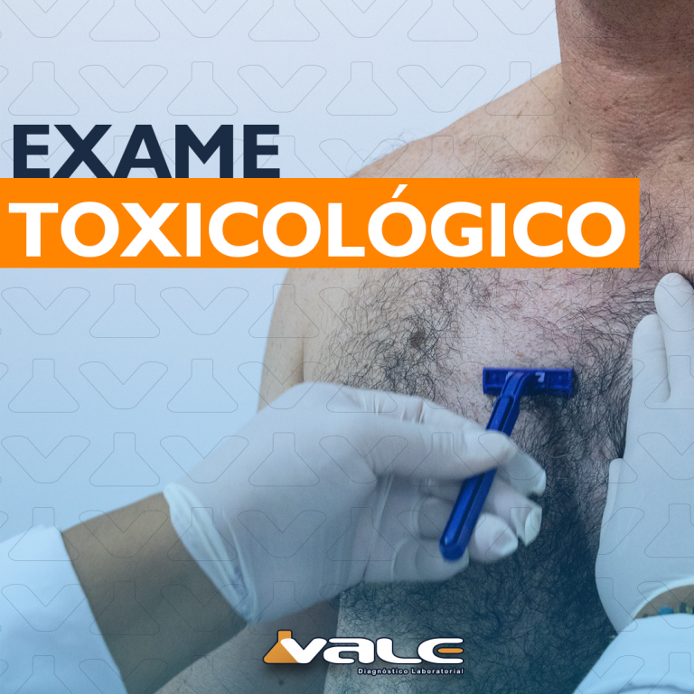 Saiba tudo sobre o Exame Toxicológico