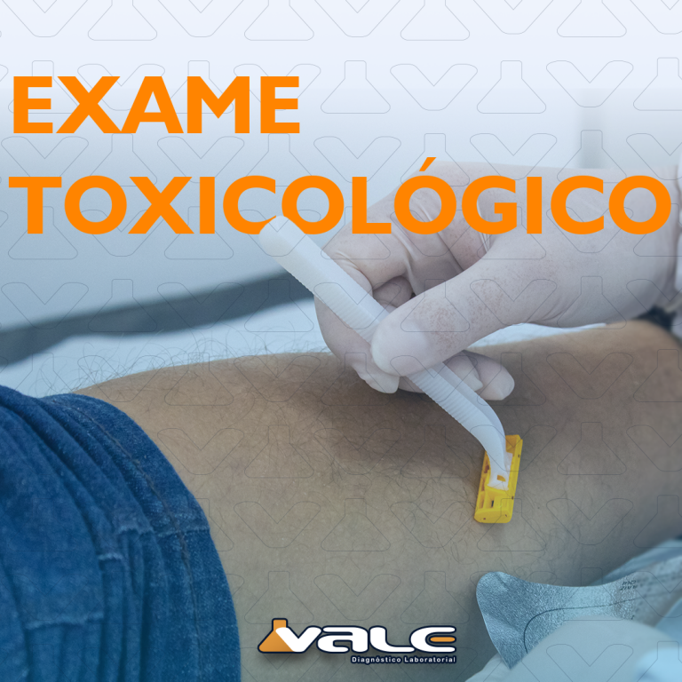 Saiba tudo sobre o Exame Toxicológico